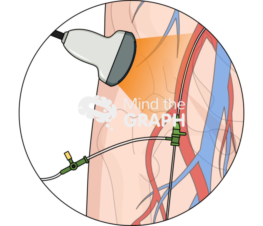 Echo guided femoral vascular access zoom Icons, Symbols, Pictures, and Images