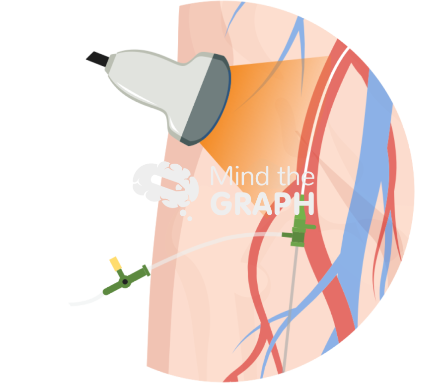 Echo guided femoral vascular access zoom Icons, Symbols, Pictures, and Images