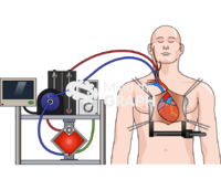 Open heart surgery ecmo Icons, Symbols, Pictures, and Images