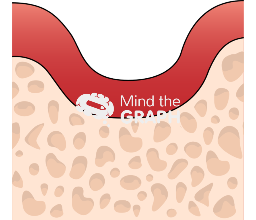 Edentulism and bone resorption Icons, Symbols, Pictures, and Images