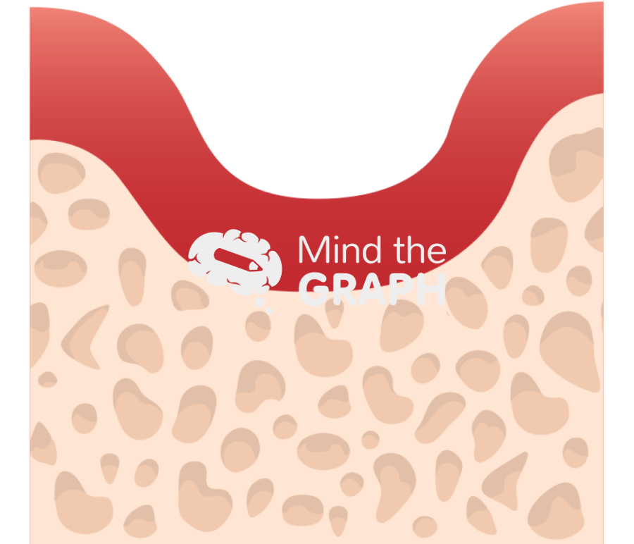 Edentulism and bone resorption Icons, Symbols, Pictures, and Images