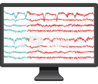 Eeg normal seizure activity 1 Icons, Symbols, Pictures, and Images