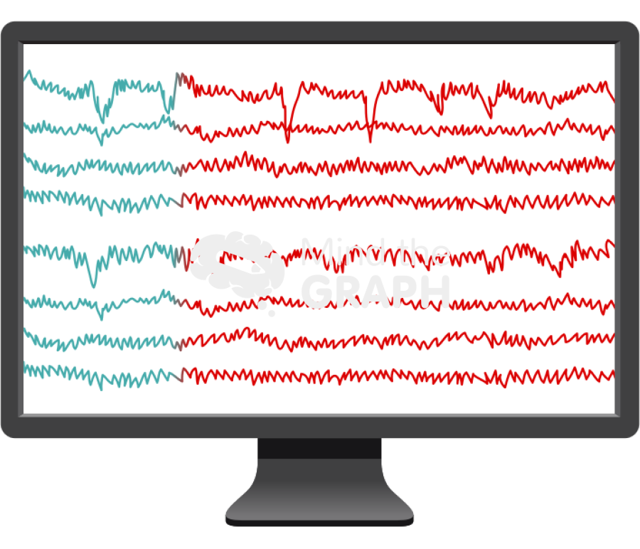 Eeg normal seizure activity 1 Icons, Symbols, Pictures, and Images