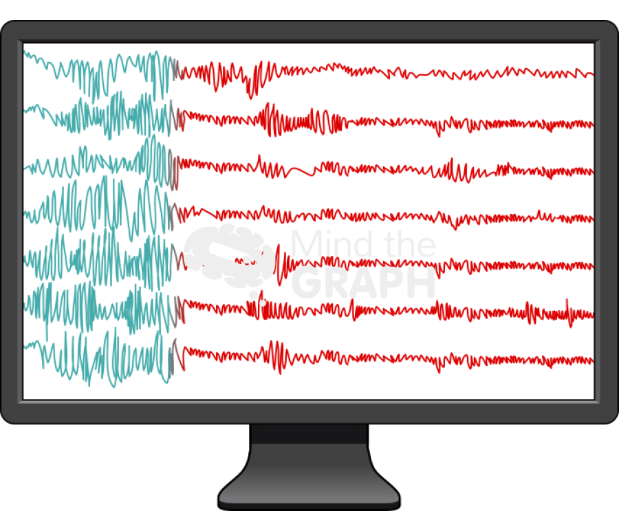 Eeg normal seizure activity 2 Icons, Symbols, Pictures, and Images
