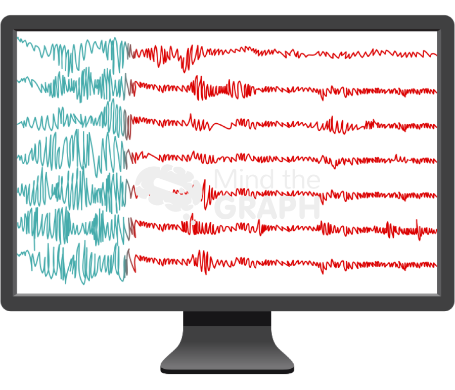 Eeg normal seizure activity 2 Icons, Symbols, Pictures, and Images