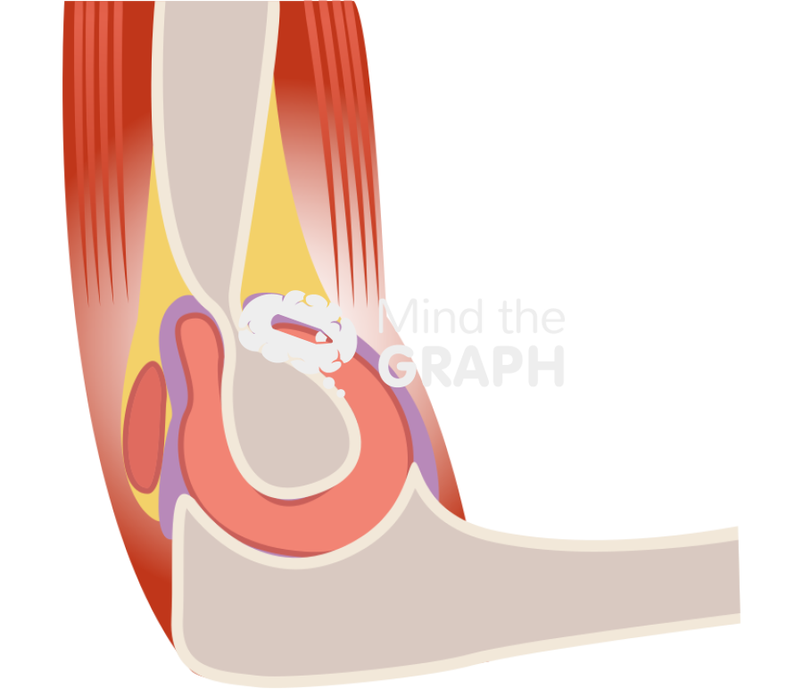 Elbow lateral view Icons, Symbols, Pictures, and Images