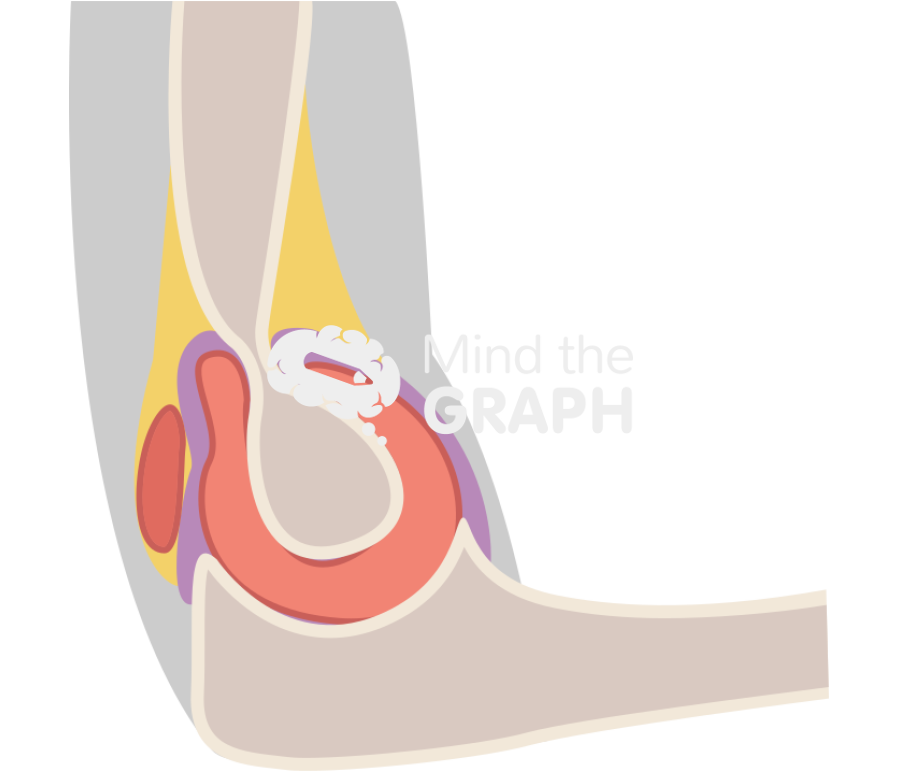 Elbow lateral view body Icons, Symbols, Pictures, and Images