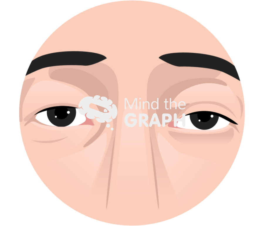 Elderly eye drop treatment zoom Icons, Symbols, Pictures, and Images