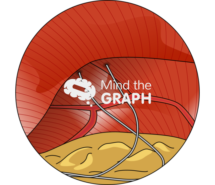 Electrode implanted diaphragm zoom Icons, Symbols, Pictures, and Images