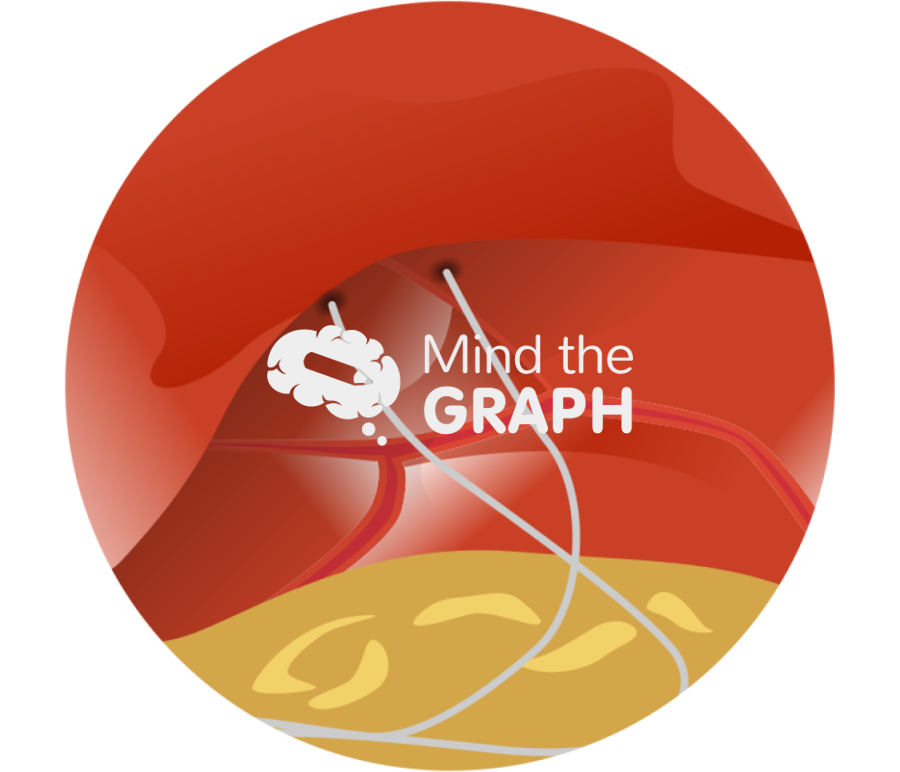 Electrode implanted diaphragm zoom Icons, Symbols, Pictures, and Images