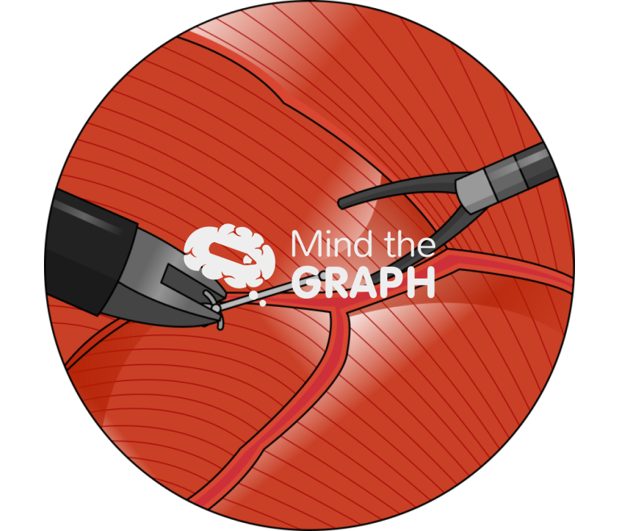 Electrode insertion diaphragm zoom Icons, Symbols, Pictures, and Images