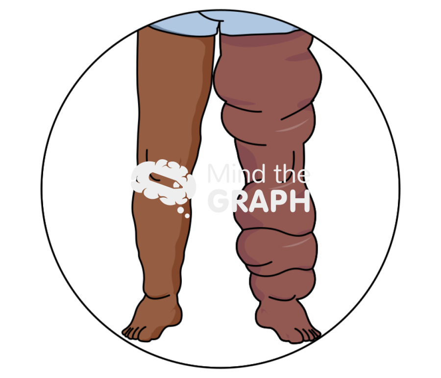 Elephantiasis Icons, Symbols, Pictures, and Images