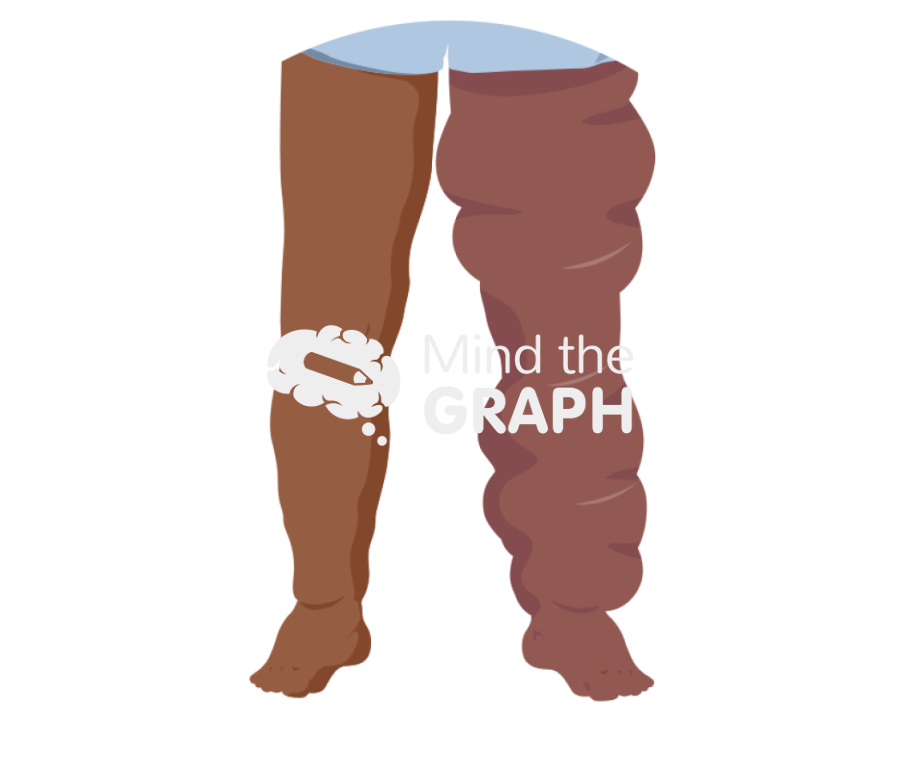 Elephantiasis Icons, Symbols, Pictures, and Images