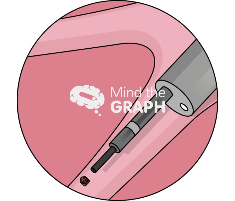 Enb guided rfid marking lung 2 zoom Icons, Symbols, Pictures, and Images