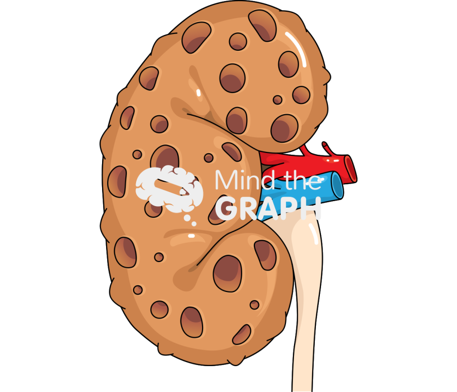 End stage renal disease Icons, Symbols, Pictures, and Images