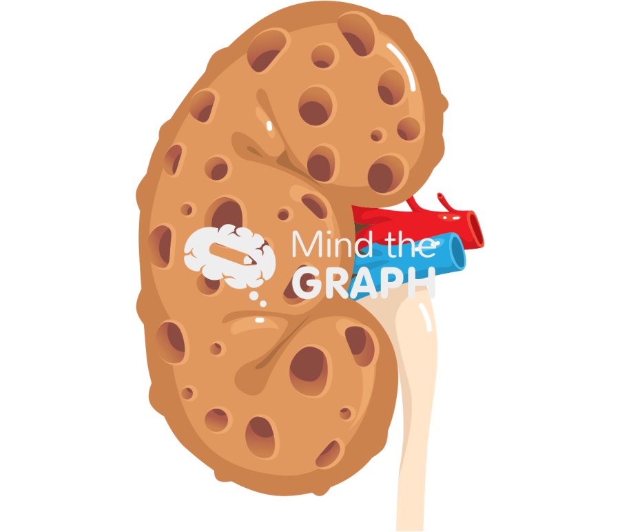 End stage renal disease Icons, Symbols, Pictures, and Images