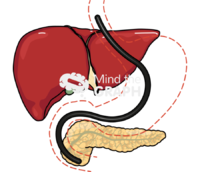 Endoscopic pancreas detail - Edit and Customize Icons of Endoscopic pancreas detail Endoscopic pancreas detail Icons, Symbols, Pictures, and Images