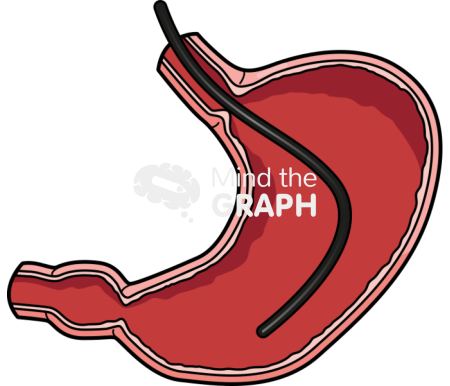 Endoscopy stomach Icons, Symbols, Pictures, and Images