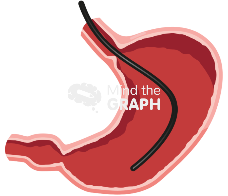 Endoscopy stomach Icons, Symbols, Pictures, and Images