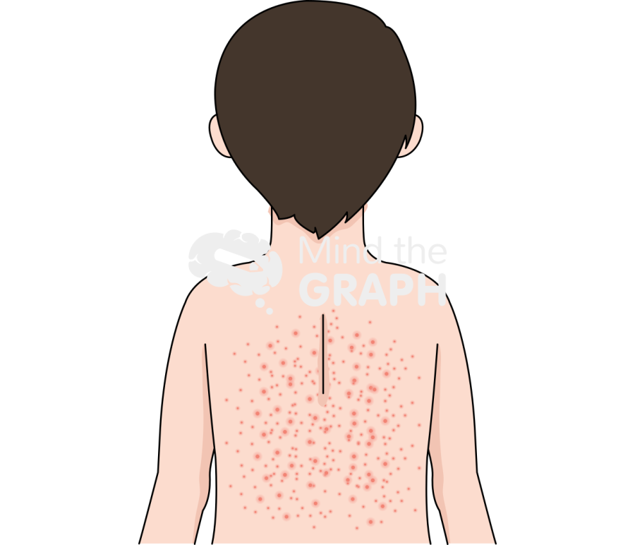 Epstein bar virus infection 2 Icons, Symbols, Pictures, and Images