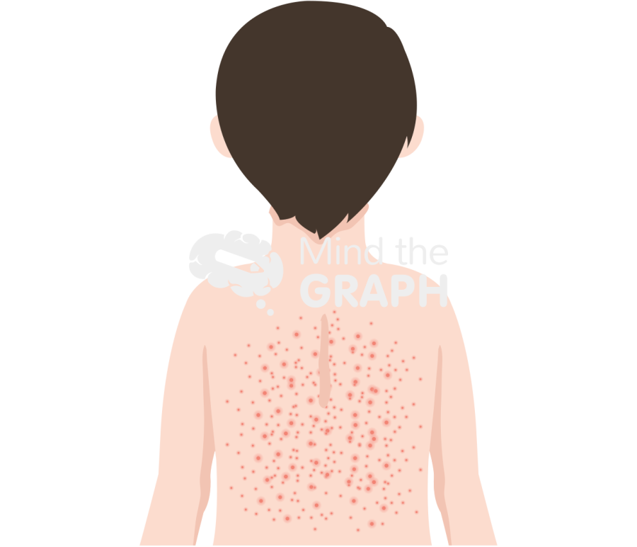 Epstein bar virus infection 2 Icons, Symbols, Pictures, and Images