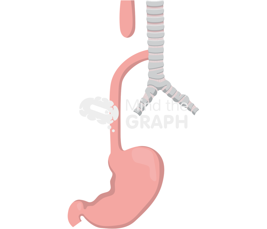 Esophageal atresia Icons, Symbols, Pictures, and Images