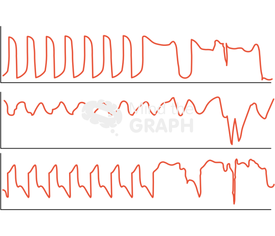 Esophageal pressure Icons, Symbols, Pictures, and Images