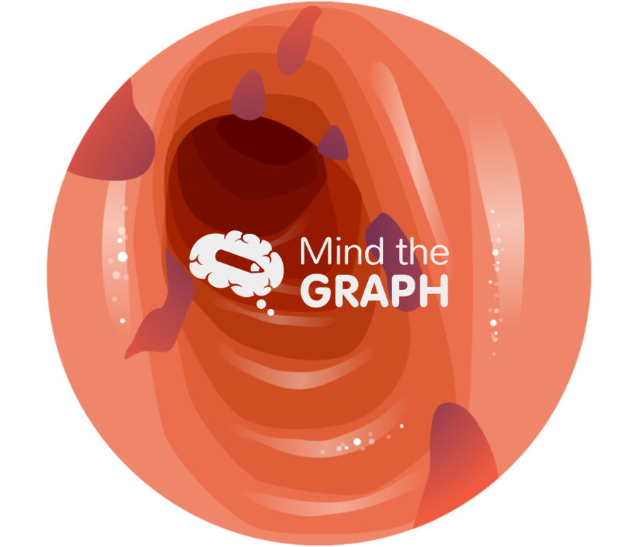 Esophageal varices zoom Icons, Symbols, Pictures, and Images