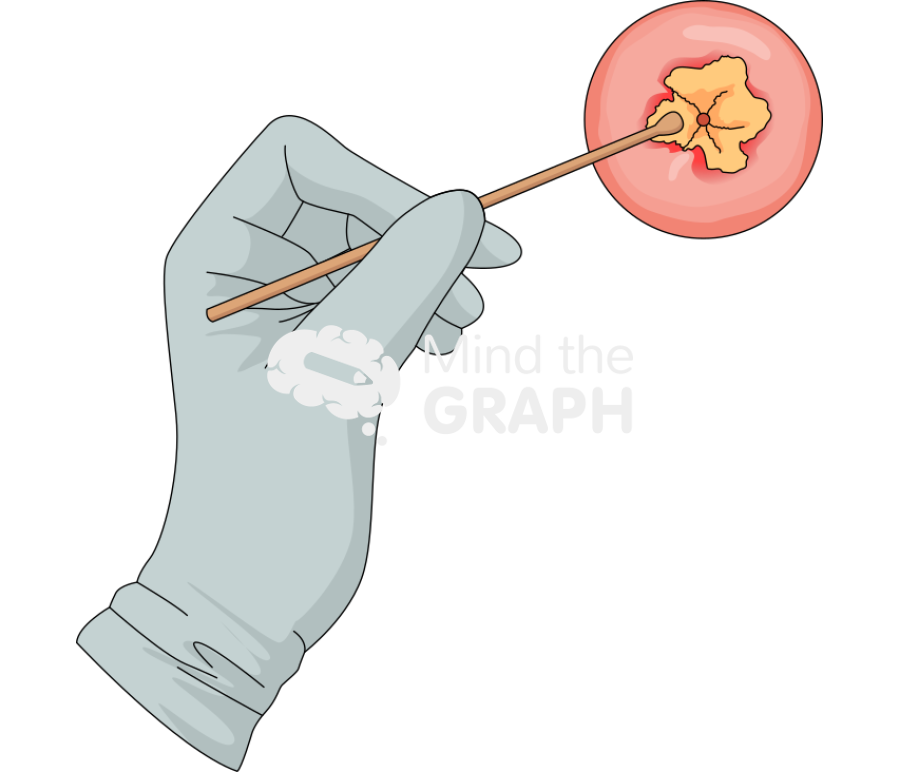 Exam cervix infection hand Icons, Symbols, Pictures, and Images