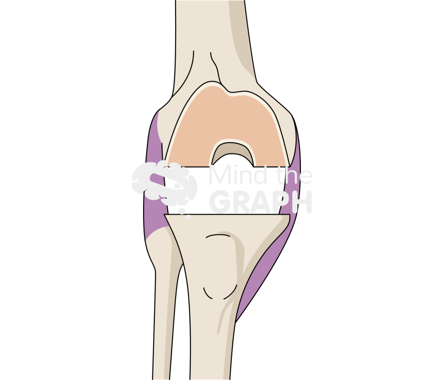 Extension gap knee Icons, Symbols, Pictures, and Images