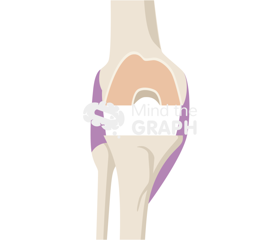 Extension gap knee Icons, Symbols, Pictures, and Images