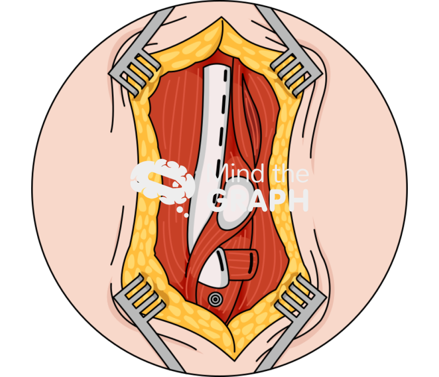 Extensor mesh zoom Icons, Symbols, Pictures, and Images