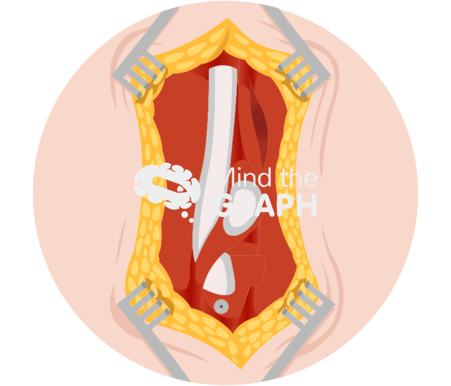 Extensor mesh zoom Icons, Symbols, Pictures, and Images