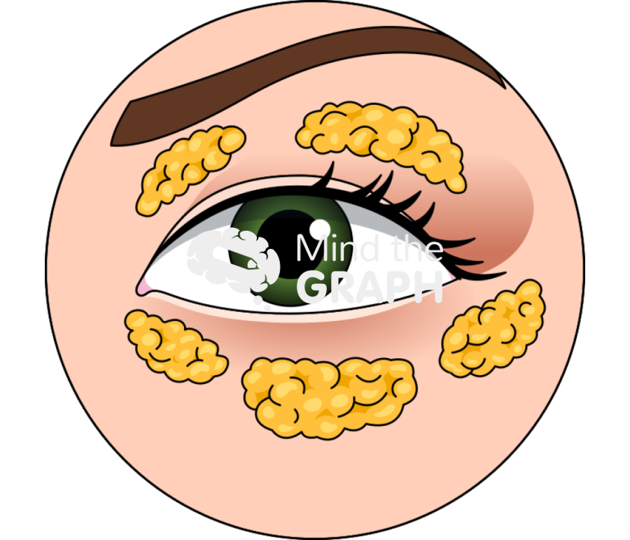 Eye periorbital fat zoom Icons, Symbols, Pictures, and Images