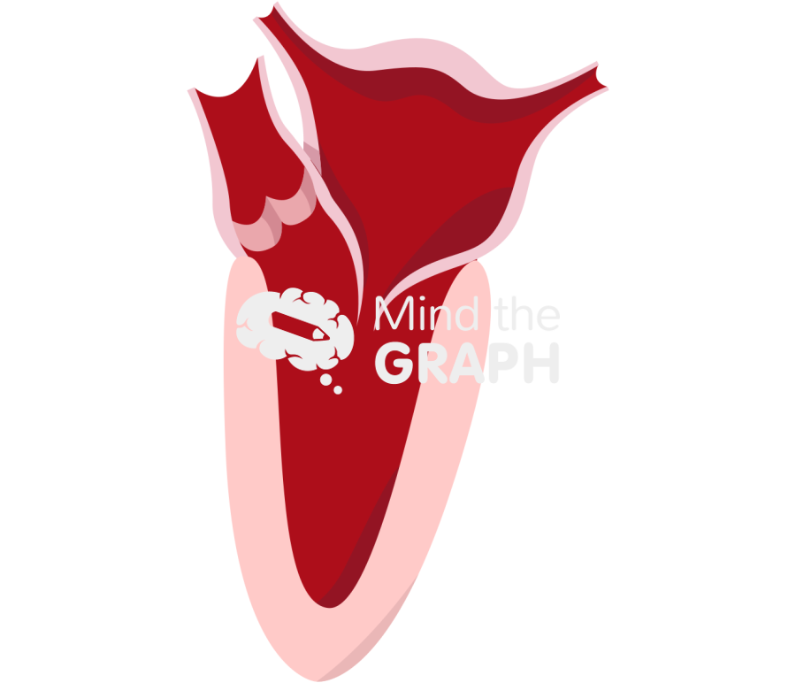 Female heart after bariatric surgery Icons, Symbols, Pictures, and Images