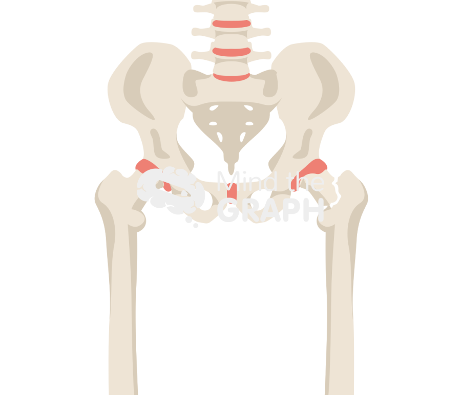 Femoral neck fracture 2 bone full Icons, Symbols, Pictures, and Images