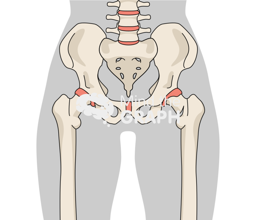 Femoral neck fracture body Icons, Symbols, Pictures, and Images