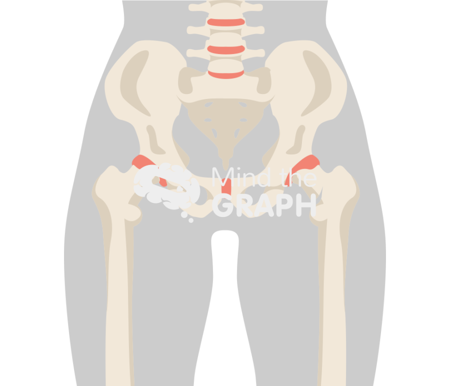 Femoral neck fracture body Icons, Symbols, Pictures, and Images