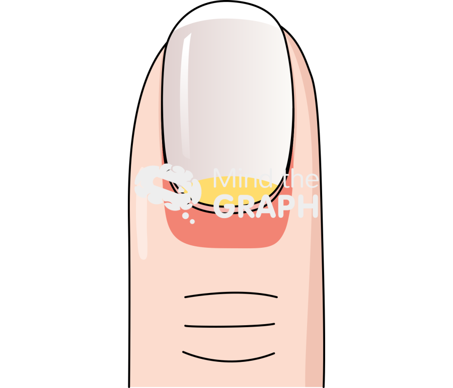 Finger nail front 2 Icons, Symbols, Pictures, and Images