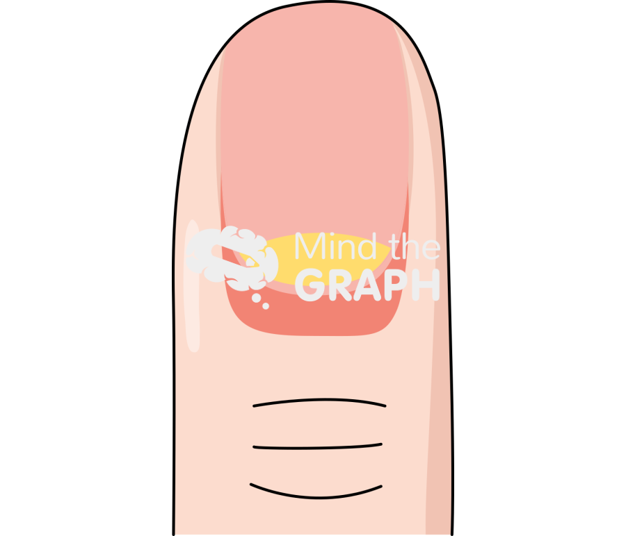 Finger nail front 3 Icons, Symbols, Pictures, and Images