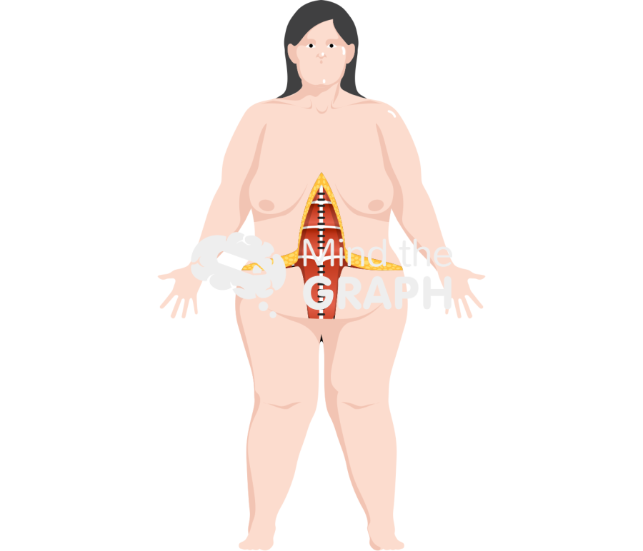 Fleur de lis panniculectomy Icons, Symbols, Pictures, and Images