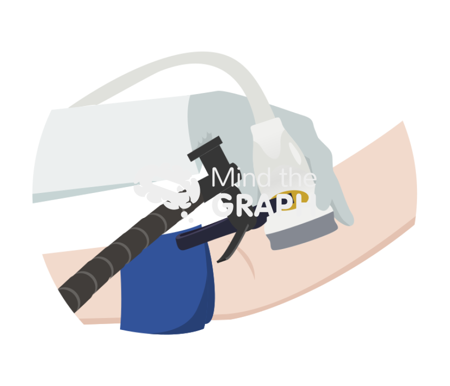 Fmd flow mediated dilation measure Icons, Symbols, Pictures, and Images