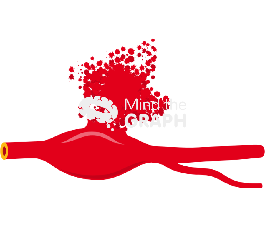 Fusiform aneurysm open Icons, Symbols, Pictures, and Images