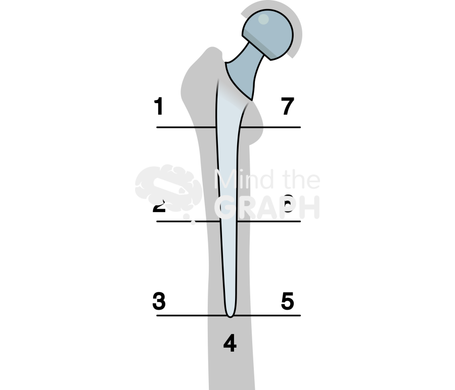 Gruen zones anteroposterior bone Icons, Symbols, Pictures, and Images