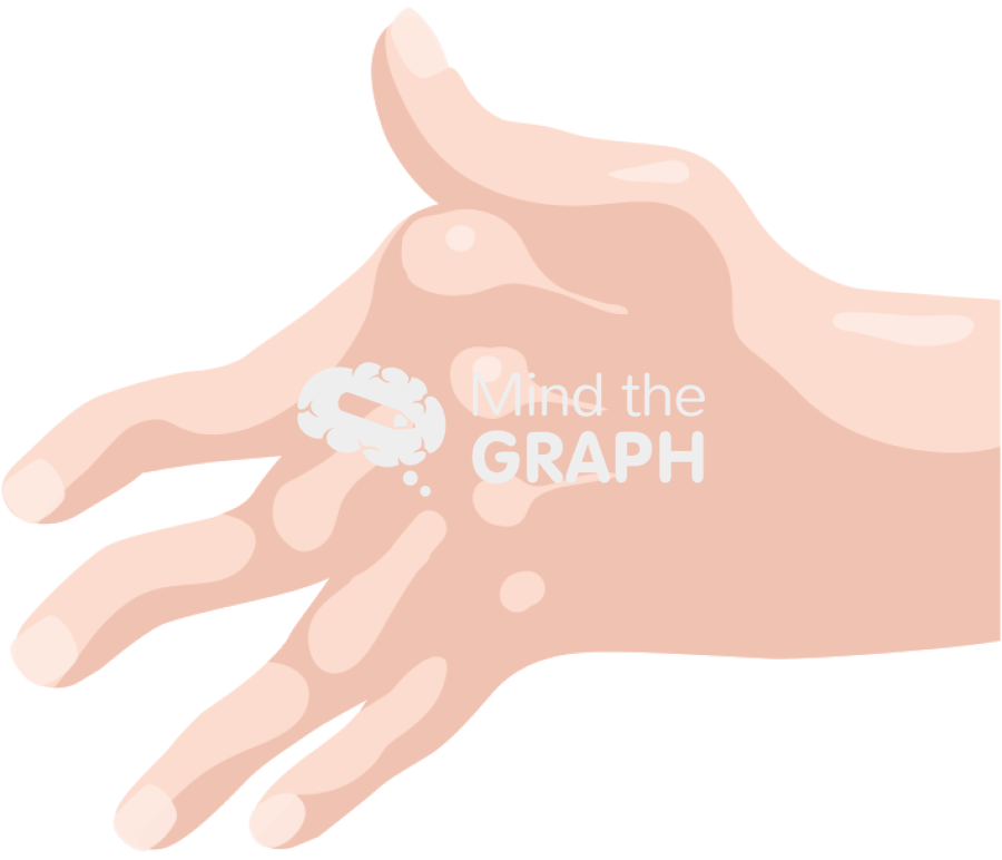 Hand arthritis Icons, Symbols, Pictures, and Images