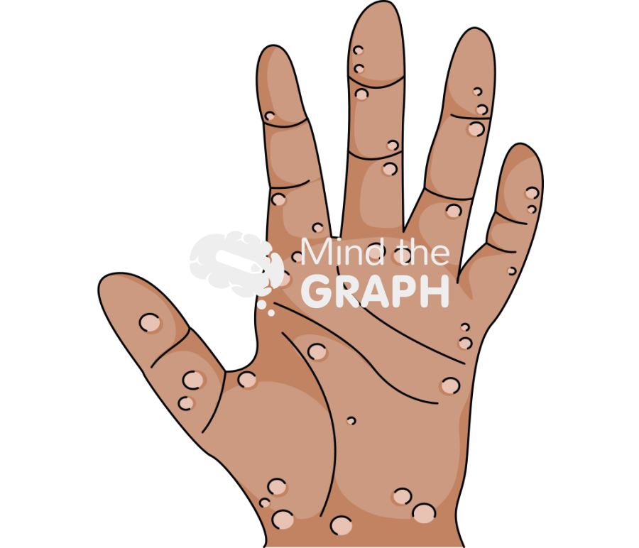 Hand monkeypox blisters skin Icons, Symbols, Pictures, and Images