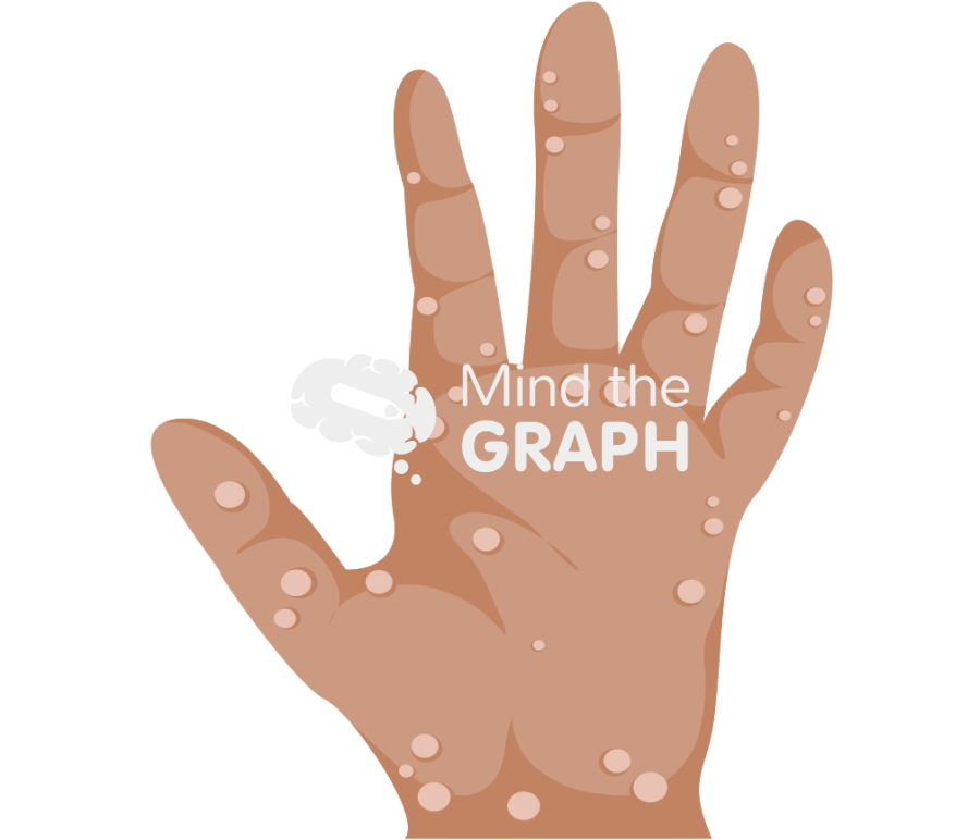 Hand monkeypox blisters skin Icons, Symbols, Pictures, and Images