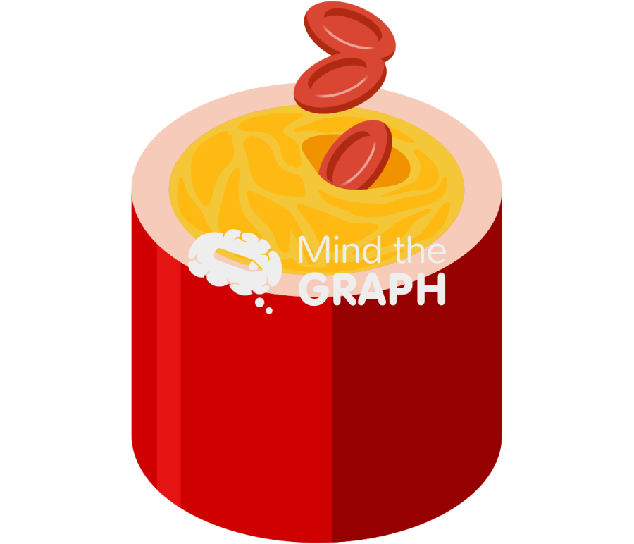 Hardened artery plaque occlusion Icons, Symbols, Pictures, and Images