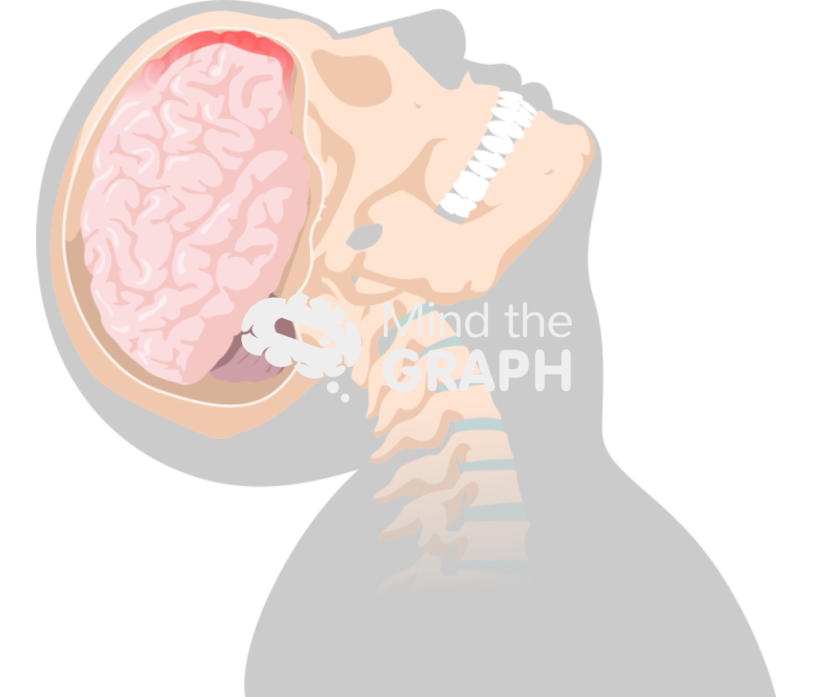 Head movement diffuse axonal injury 2 Icons, Symbols, Pictures, and Images
