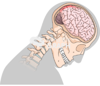 Head movement diffuse axonal injury 3 Icons, Symbols, Pictures, and Images